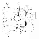 Fig. 01 - FLEXIBLE STABILIZATION DEVICE FOR DYNAMIC STABILIZATION OF BONES OR VERTEBRAE