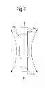 Fig. 07 - FLEXIBLE STABILIZATION DEVICE FOR DYNAMIC STABILIZATION OF BONES OR VERTEBRAE