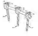 Fig. 01 - Rod contouring method for percutaneous pedicle screw extension