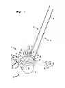 Fig. 02 - Rod contouring method for percutaneous pedicle screw extension
