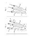 Fig. 04 - Rod contouring method for percutaneous pedicle screw extension