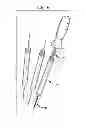 Fig. 05 - Rod contouring method for percutaneous pedicle screw extension
