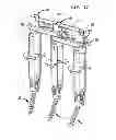 Fig. 10 - Rod contouring method for percutaneous pedicle screw extension