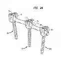 Fig. 20 - Rod contouring method for percutaneous pedicle screw extension