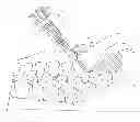 Fig. 01 - Spinal fixation tool set and method
