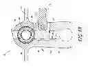 Fig. 09 - MINIMALLY INVASIVE DEVICES, SYSTEMS AND METHODS FOR TREATING THE SPINE