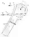 Fig. 01 - Method of reduction of proximal humeral fracture