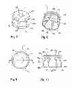 Fig. 04 - Polyaxial bone anchoring device with enlarged pivot angle