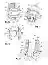 Fig. 09 - Polyaxial bone anchoring device with enlarged pivot angle