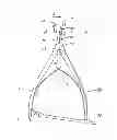Fig. 01 - Surgical reduction clamp