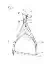 Fig. 02 - Surgical reduction clamp