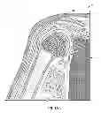Fig. 02 - METHOD AND DEVICE FOR POST-OPERATIVE APPLICATION OF PULSED RADIOFREQUENCY FOR PREVENTION OF PAIN AND CARTILAGE LOSS