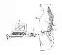 Fig. 01 - Techniques for electronically assessing electrode condition and peri-electrode tissue conductivity change pre- and post-MRI