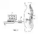 Fig. 04 - Techniques for electronically assessing electrode condition and peri-electrode tissue conductivity change pre- and post-MRI