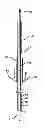 Fig. 01 - Minimally invasive methods for implanting a sacral stimulation lead