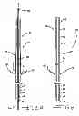 Fig. 05 - Minimally invasive methods for implanting a sacral stimulation lead