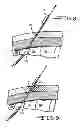 Fig. 07 - Minimally invasive methods for implanting a sacral stimulation lead