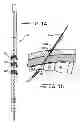 Fig. 09 - Minimally invasive methods for implanting a sacral stimulation lead