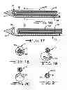 Fig. 10 - Minimally invasive methods for implanting a sacral stimulation lead