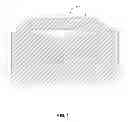 Fig. 02 - Implant encapsulation