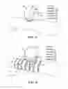 Fig. 19 - Endovascular stent