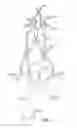 Fig. 04 - SYSTEMS AND METHODS FOR TRANSCERVICAL AORTIC VALVE TREATMENT