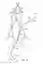 Fig. 09 - SYSTEMS AND METHODS FOR TRANSCERVICAL AORTIC VALVE TREATMENT