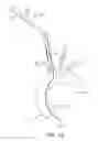 Fig. 11 - SYSTEMS AND METHODS FOR TRANSCERVICAL AORTIC VALVE TREATMENT