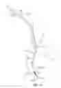 Fig. 12 - SYSTEMS AND METHODS FOR TRANSCERVICAL AORTIC VALVE TREATMENT