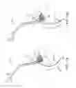 Fig. 15 - SYSTEMS AND METHODS FOR TRANSCERVICAL AORTIC VALVE TREATMENT