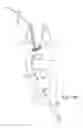 Fig. 16 - SYSTEMS AND METHODS FOR TRANSCERVICAL AORTIC VALVE TREATMENT