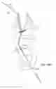 Fig. 17 - SYSTEMS AND METHODS FOR TRANSCERVICAL AORTIC VALVE TREATMENT