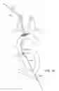 Fig. 18 - SYSTEMS AND METHODS FOR TRANSCERVICAL AORTIC VALVE TREATMENT
