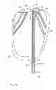 Fig. 09 - Device and method for heart valve repair