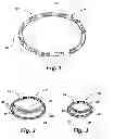 Fig. 02 - IMPLANTABLE DEVICES FOR CONTROLLING THE INTERNAL CIRCUMFERENCE OF AN ANATOMIC ORIFICE OR LUMEN