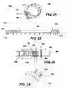 Fig. 09 - IMPLANTABLE DEVICES FOR CONTROLLING THE INTERNAL CIRCUMFERENCE OF AN ANATOMIC ORIFICE OR LUMEN