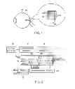 Fig. 02 - Retinal prosthesis with efficient processing circuits