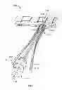 Fig. 41 - Double bundle ACL repair