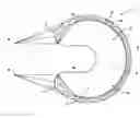 Fig. 01 - Implantable device and method to replace the meniscus of the knee and other body structures