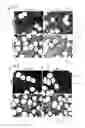 Fig. 28 - Implantable device and method to replace the meniscus of the knee and other body structures