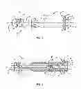 Fig. 02 - SACRO-ILIAC JOINT IMPLANT SYSTEM AND METHOD