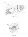 Fig. 06 - SACRO-ILIAC JOINT IMPLANT SYSTEM AND METHOD