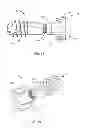 Fig. 08 - SACRO-ILIAC JOINT IMPLANT SYSTEM AND METHOD