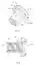 Fig. 09 - SACRO-ILIAC JOINT IMPLANT SYSTEM AND METHOD