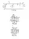 Fig. 07 - Systems for and methods of fusing a sacroiliac joint