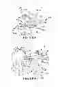 Fig. 136 - Systems for and methods of fusing a sacroiliac joint