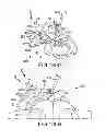 Fig. 137 - Systems for and methods of fusing a sacroiliac joint