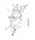 Fig. 149 - Systems for and methods of fusing a sacroiliac joint