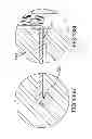 Fig. 167 - Systems for and methods of fusing a sacroiliac joint