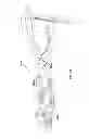Fig. 201 - Systems for and methods of fusing a sacroiliac joint